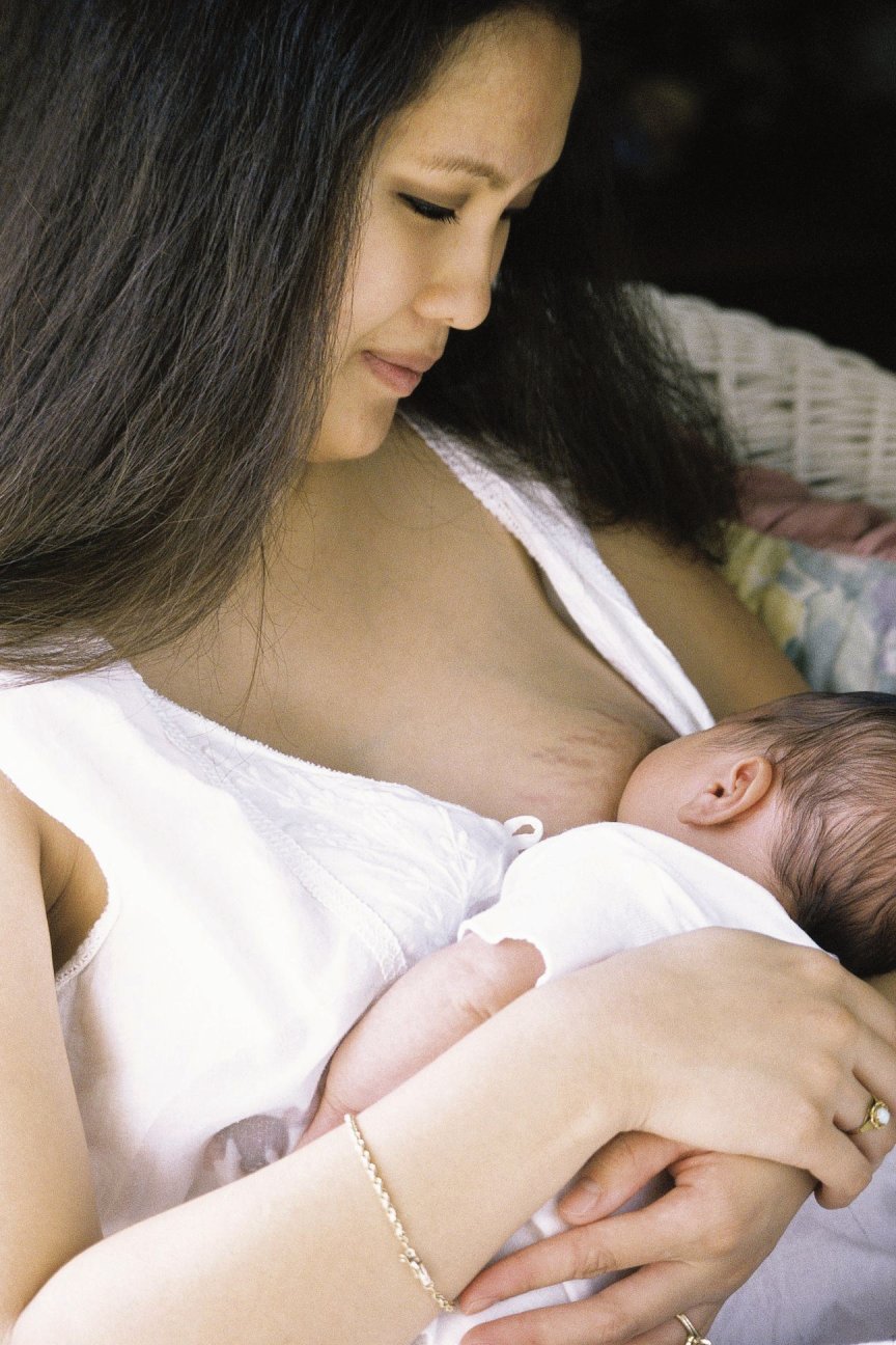 выделения из груди у беременных женщин фото 110